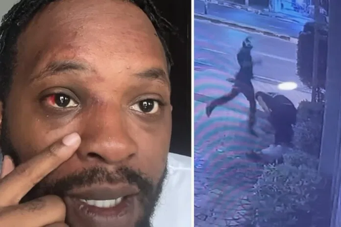 Pattaya: American content creator ambushed outside bar, has camera and passport stolen